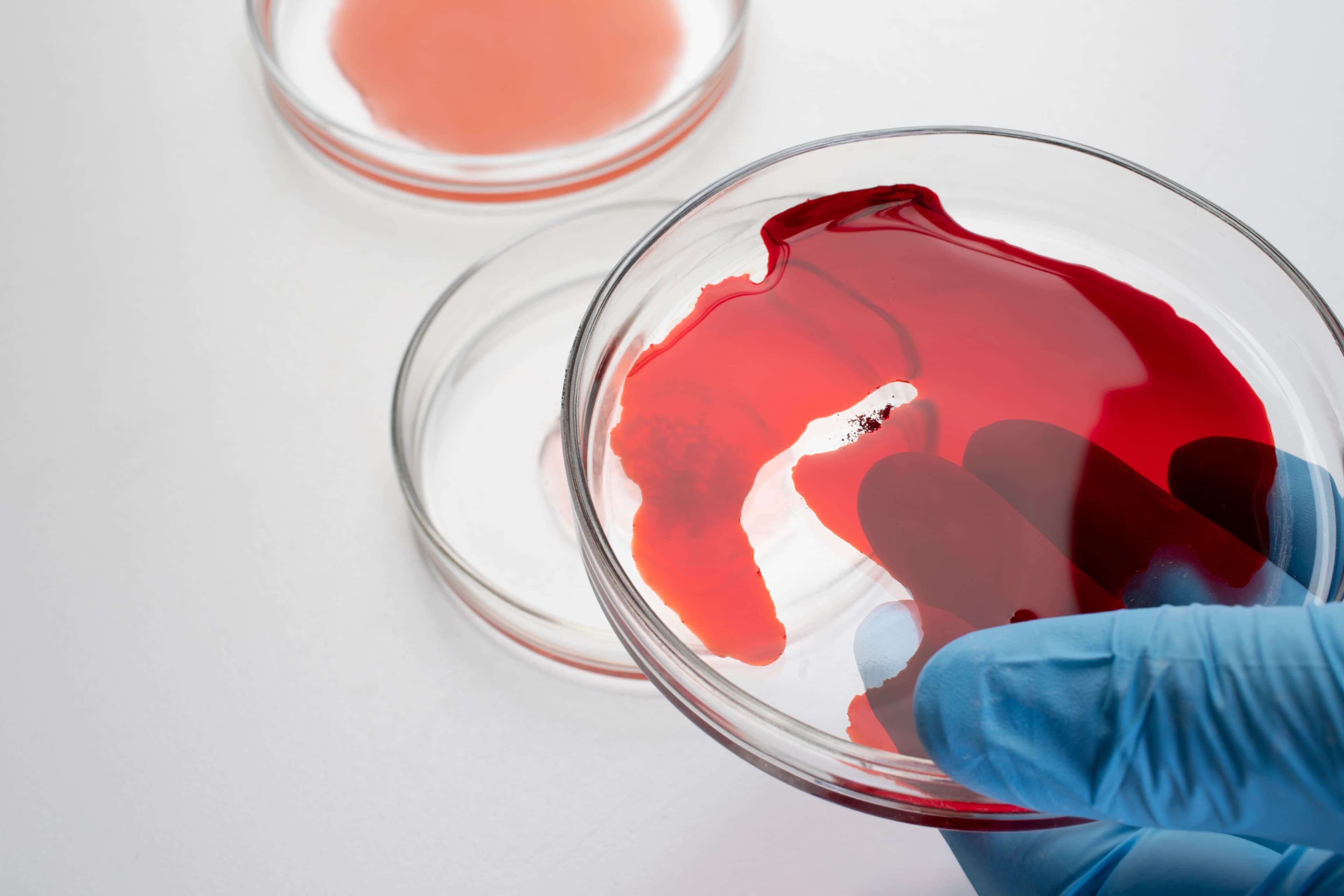 Phlebotomy