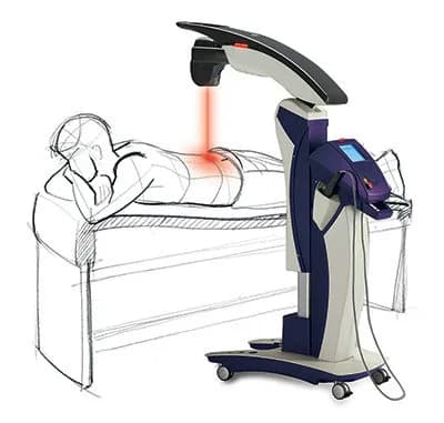 MLS Laser Therapy at RegenLife Centers Montgomery
