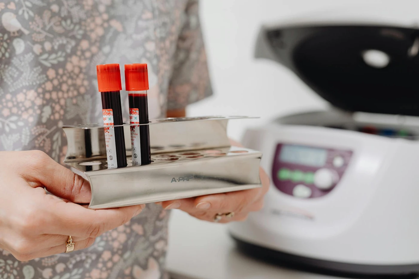 Hormone Testing Cincinnati OH: What a Full Panel Reveals That Basic Bloodwork Misses